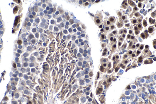 FTO Antibody in Immunohistochemistry (Paraffin) (IHC (P))