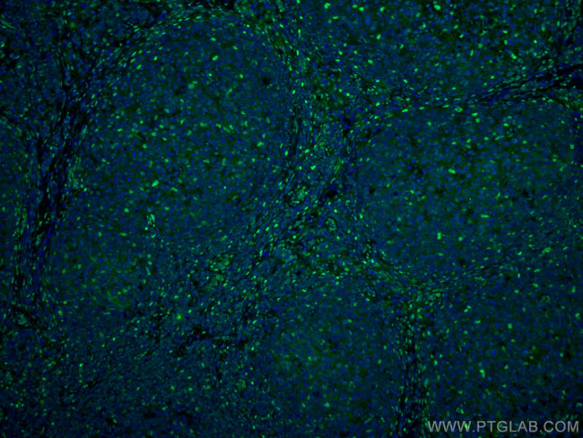 FTO Antibody in Immunohistochemistry (PFA fixed) (IHC (PFA))