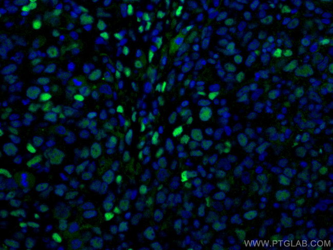 FTO Antibody in Immunohistochemistry (PFA fixed) (IHC (PFA))