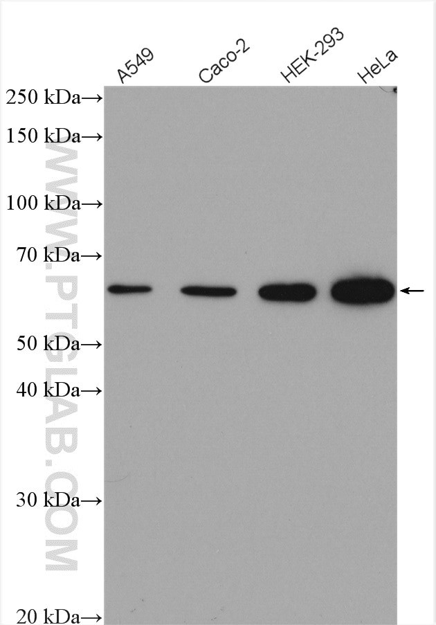 FTO Antibody in Western Blot (WB)