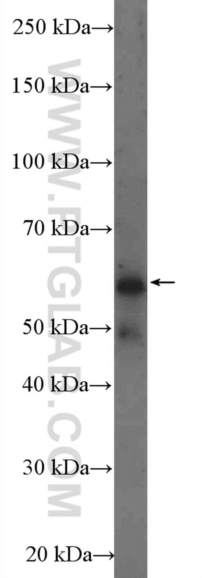 FTO Antibody in Western Blot (WB)