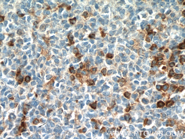 IFI44 Antibody in Immunohistochemistry (Paraffin) (IHC (P))