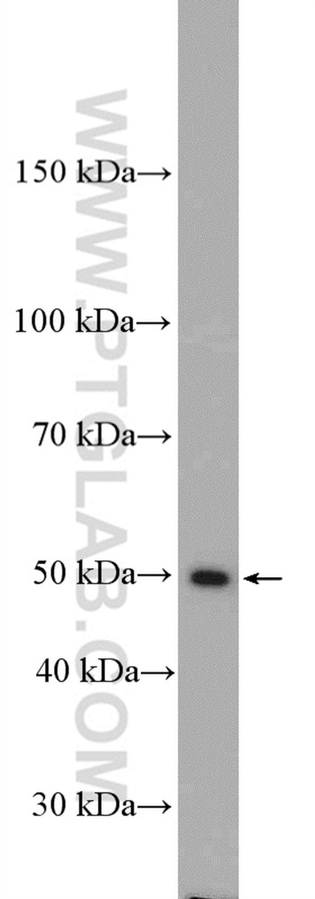 IFI44 Antibody in Western Blot (WB)