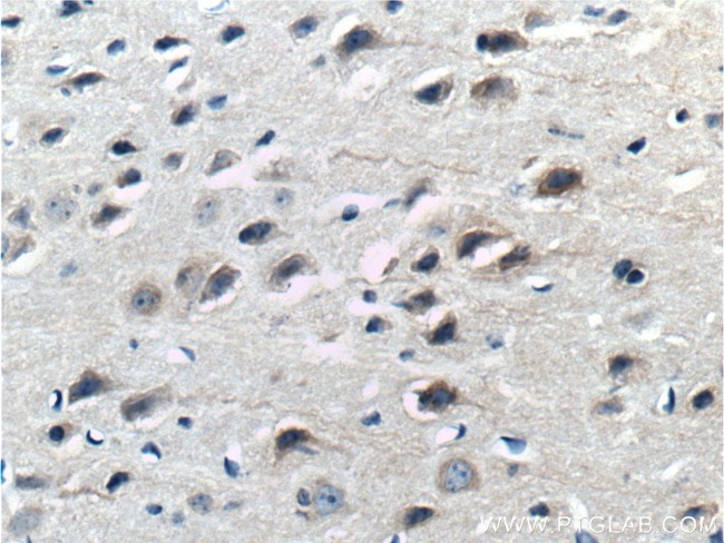 ASIC1 Antibody in Immunohistochemistry (Paraffin) (IHC (P))