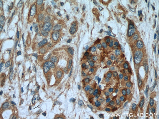 ASIC1 Antibody in Immunohistochemistry (Paraffin) (IHC (P))