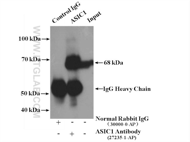 ASIC1 Antibody in Immunoprecipitation (IP)