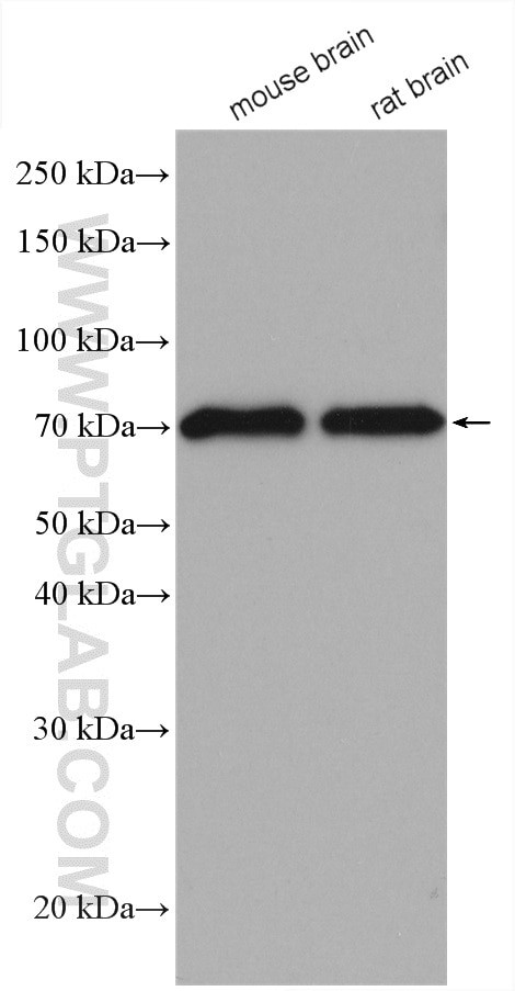 ASIC1 Antibody in Western Blot (WB)