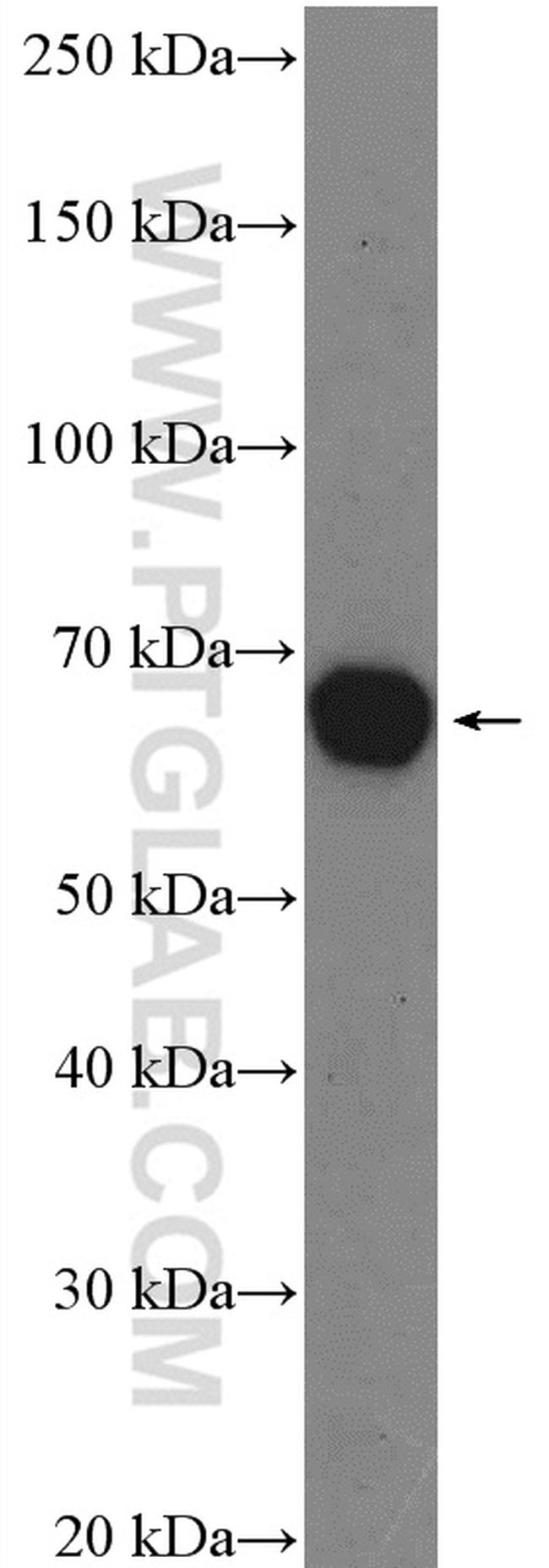 ASIC1 Antibody in Western Blot (WB)