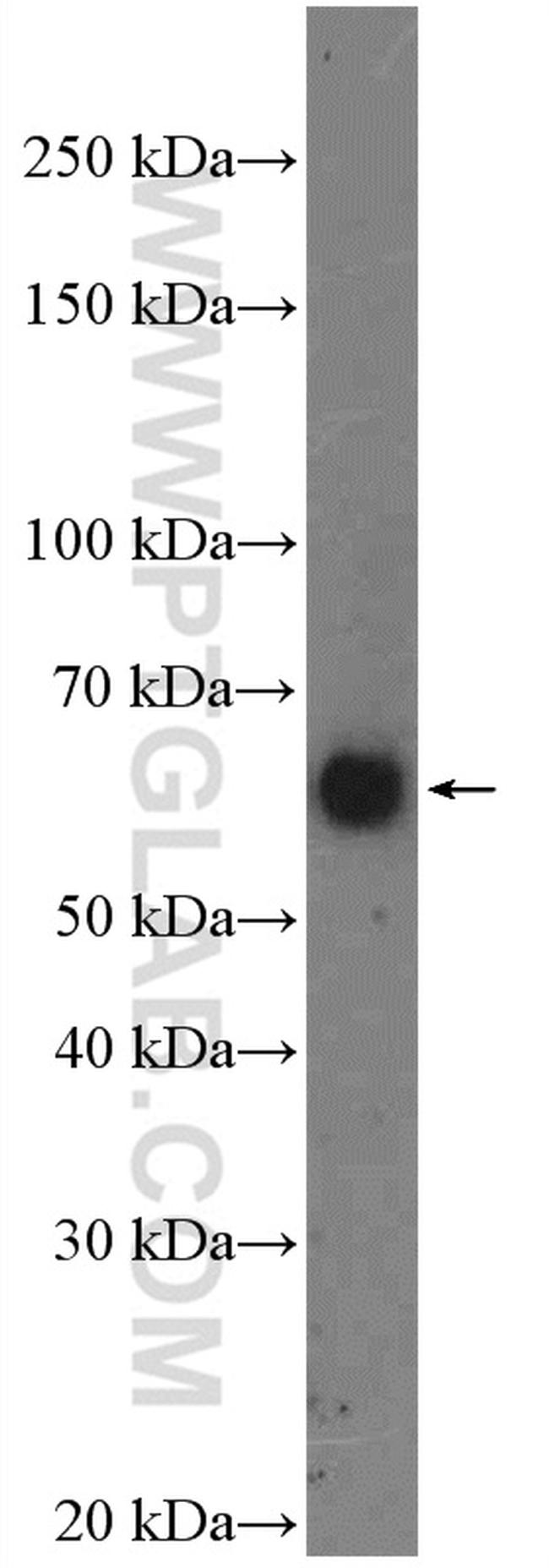 ASIC1 Antibody in Western Blot (WB)