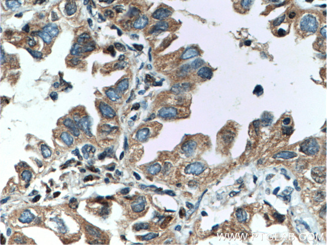 RICTOR Antibody in Immunohistochemistry (Paraffin) (IHC (P))