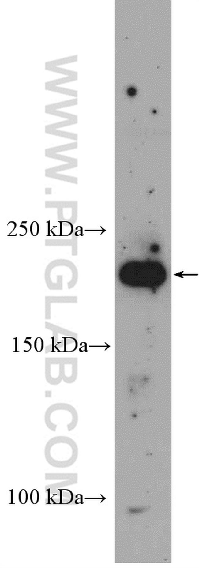 RICTOR Antibody in Western Blot (WB)