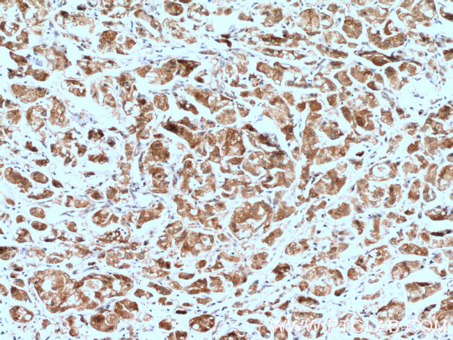 Neurofibromin Antibody in Immunohistochemistry (Paraffin) (IHC (P))