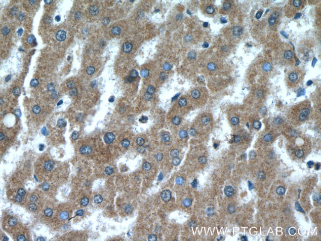 Neurofibromin Antibody in Immunohistochemistry (Paraffin) (IHC (P))