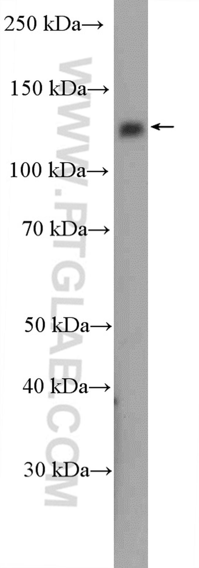 RBL2 Antibody in Western Blot (WB)