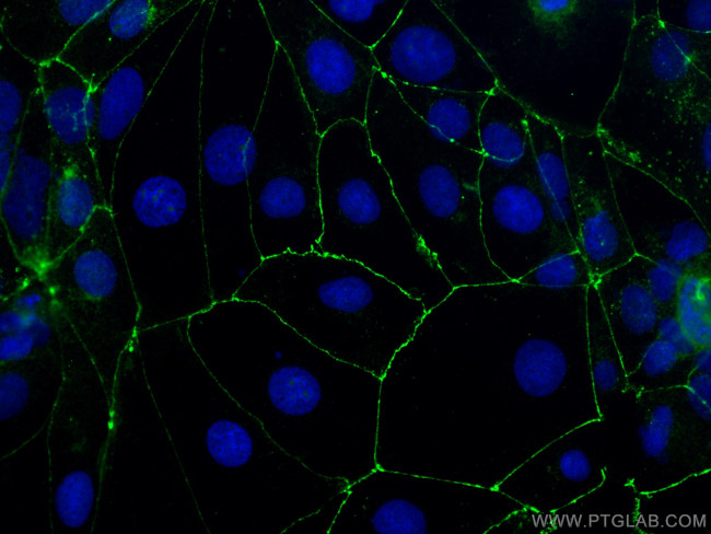 Occludin Antibody in Immunocytochemistry (ICC/IF)