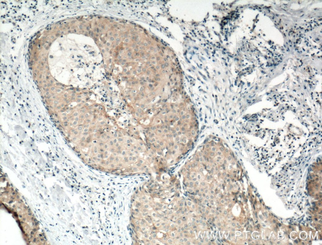 Occludin Antibody in Immunohistochemistry (Paraffin) (IHC (P))