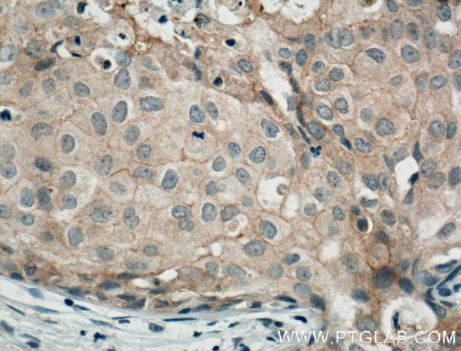 Occludin Antibody in Immunohistochemistry (Paraffin) (IHC (P))