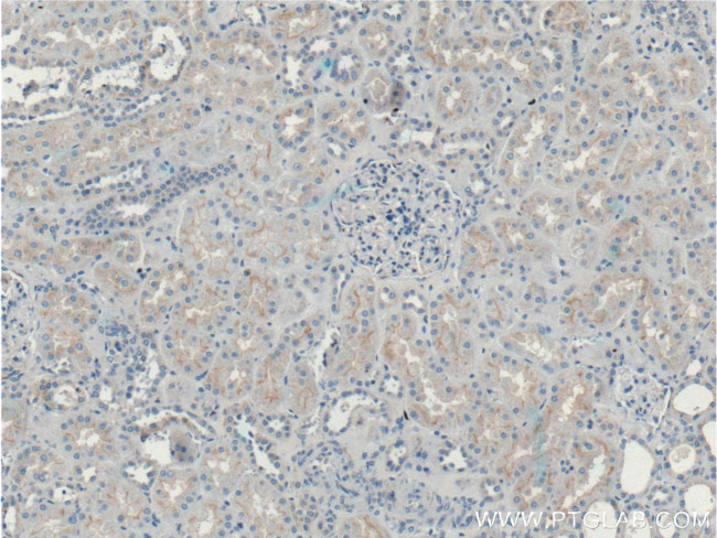 Occludin Antibody in Immunohistochemistry (Paraffin) (IHC (P))