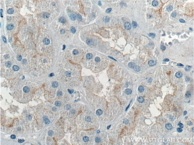 Occludin Antibody in Immunohistochemistry (Paraffin) (IHC (P))