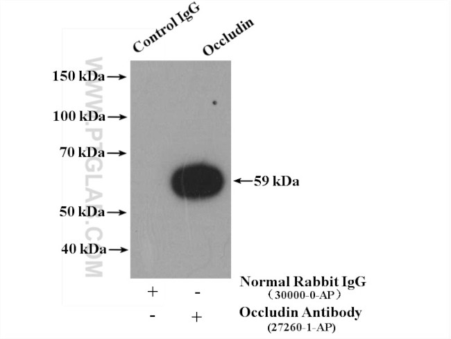 Occludin Antibody in Immunoprecipitation (IP)