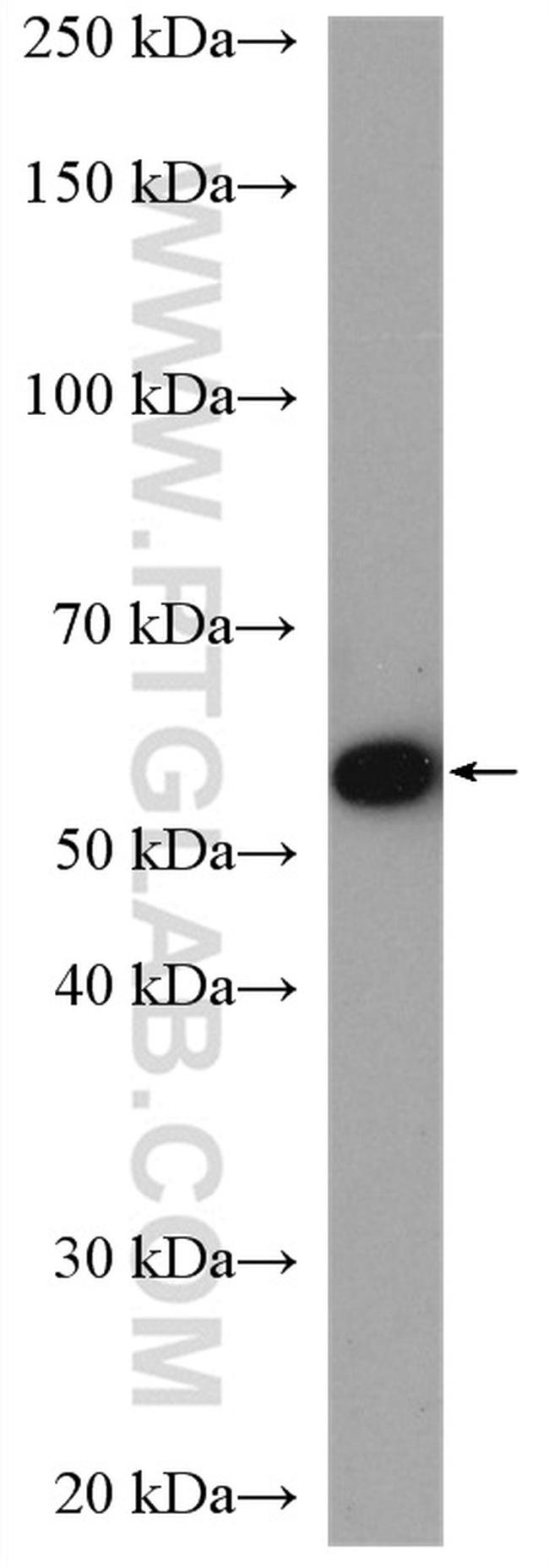 Occludin Antibody in Western Blot (WB)