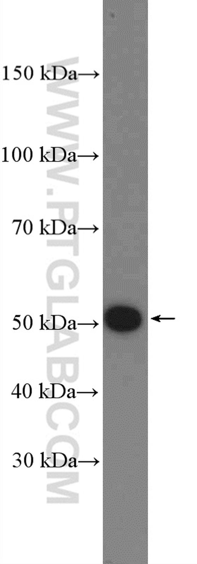 KANSL2 Antibody in Western Blot (WB)