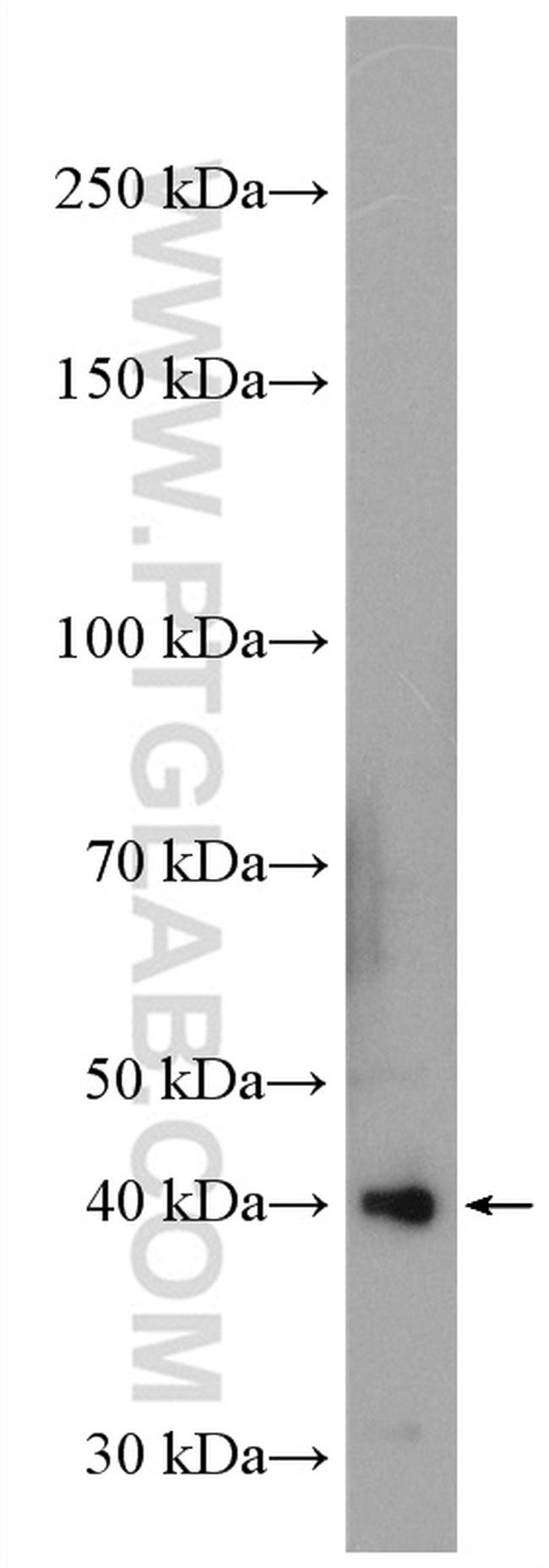 GNAQ Antibody in Western Blot (WB)