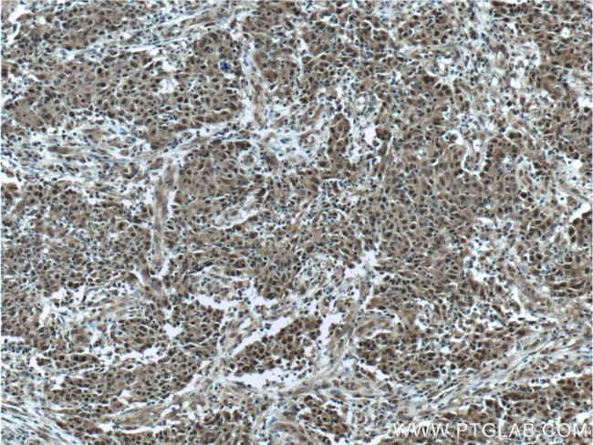 KMT2D Antibody in Immunohistochemistry (Paraffin) (IHC (P))