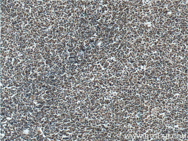 KMT2D Antibody in Immunohistochemistry (Paraffin) (IHC (P))