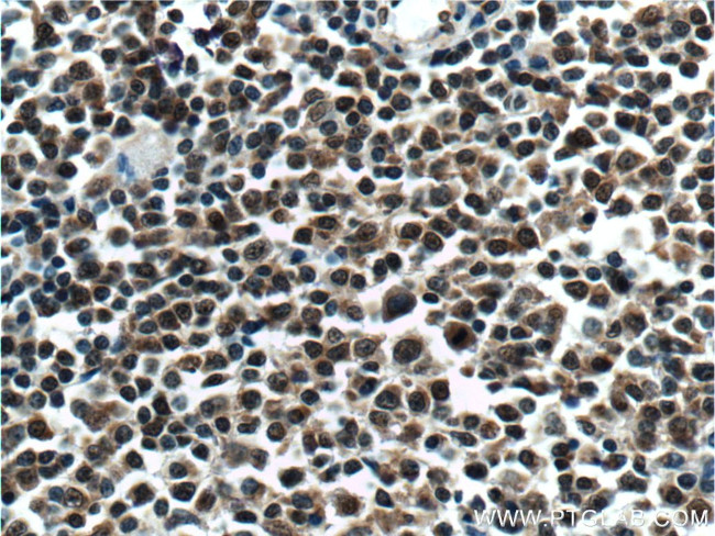 KMT2D Antibody in Immunohistochemistry (Paraffin) (IHC (P))