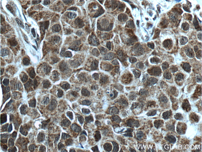 KMT2D Antibody in Immunohistochemistry (Paraffin) (IHC (P))