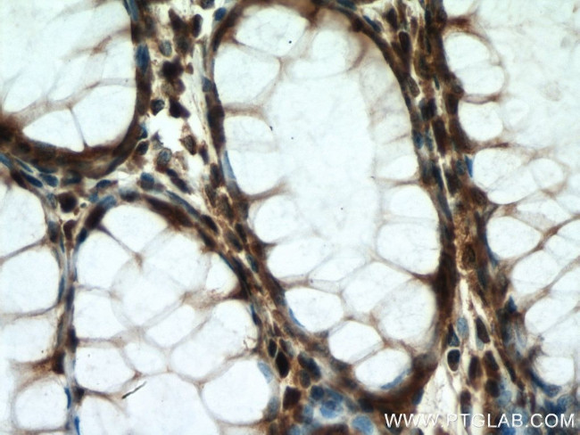 KIF20B Antibody in Immunohistochemistry (Paraffin) (IHC (P))