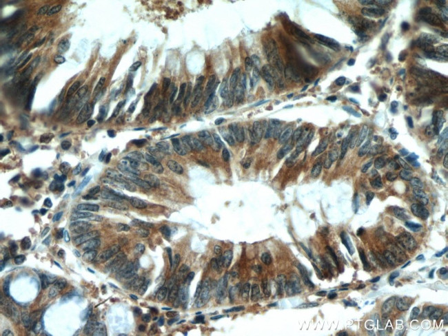 KIF20B Antibody in Immunohistochemistry (Paraffin) (IHC (P))