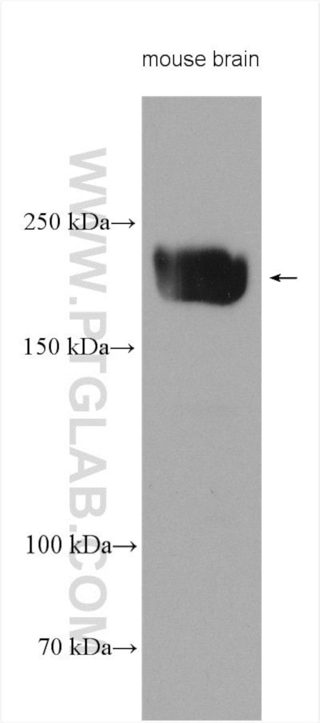 KIF20B Antibody in Western Blot (WB)
