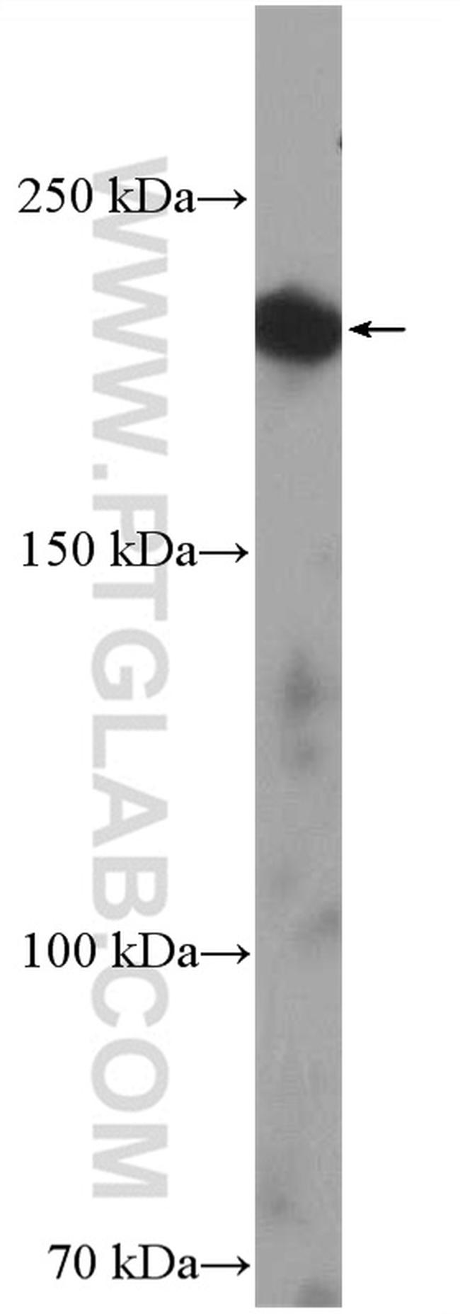 KIF21A Antibody in Western Blot (WB)