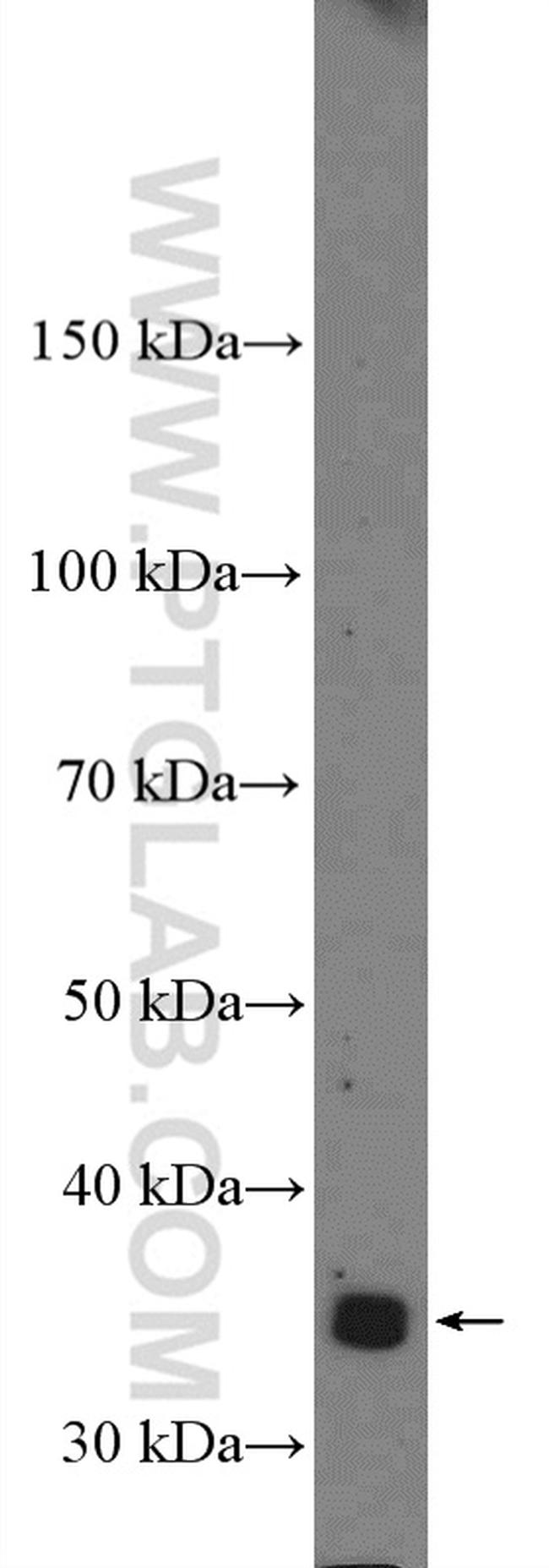 KCTD10 Antibody in Western Blot (WB)