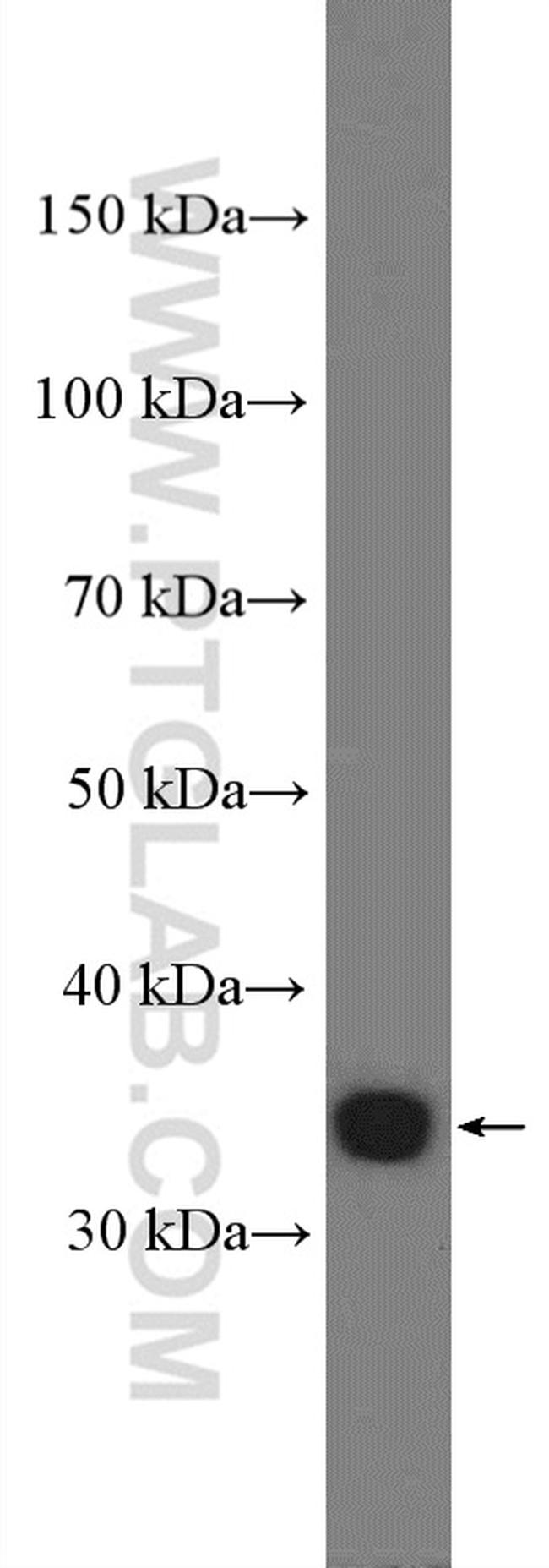 KCTD10 Antibody in Western Blot (WB)