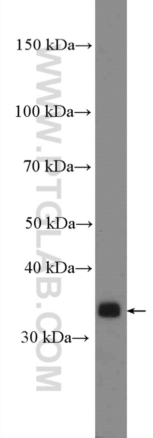 KCTD10 Antibody in Western Blot (WB)