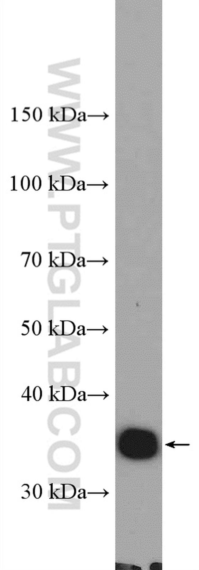 KCTD10 Antibody in Western Blot (WB)