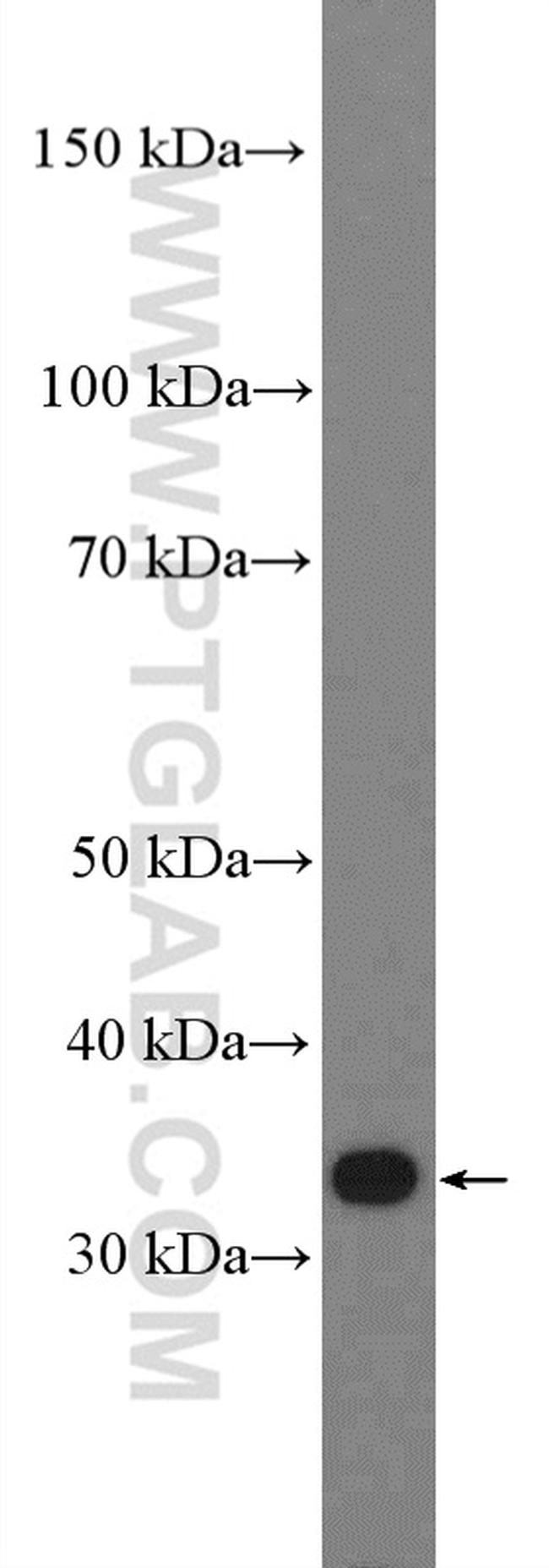 PPP1R3B Antibody in Western Blot (WB)