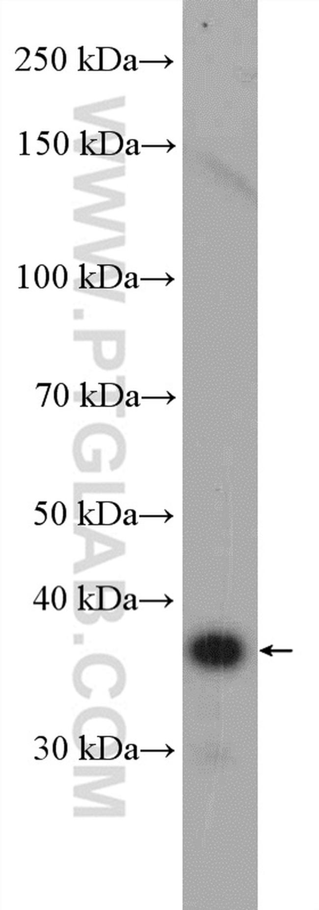 PPP1R3B Antibody in Western Blot (WB)