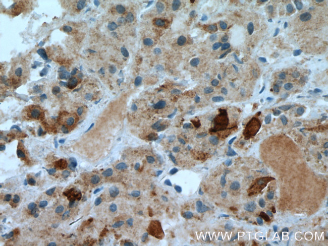 TSH beta Antibody in Immunohistochemistry (Paraffin) (IHC (P))