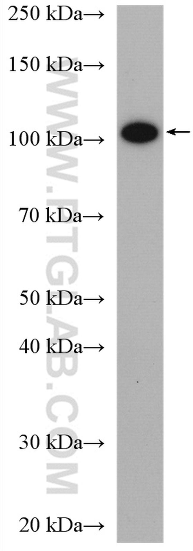 Chordin Antibody in Western Blot (WB)