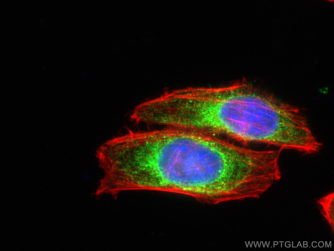 Calreticulin Antibody in Immunocytochemistry (ICC/IF)