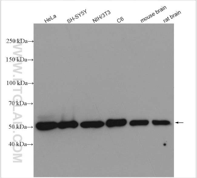 Calreticulin Antibody in Western Blot (WB)