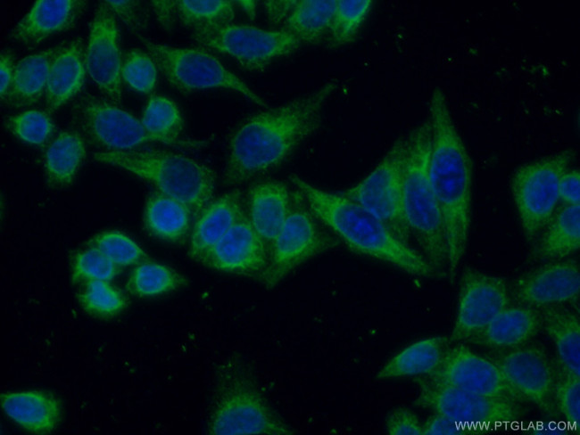 Calreticulin Antibody in Immunocytochemistry (ICC/IF)