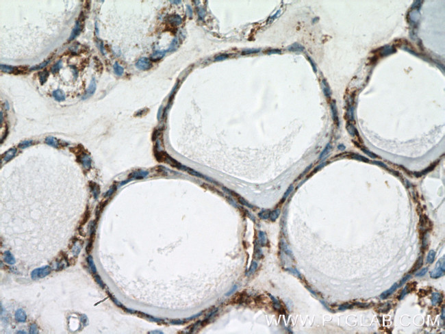 Calreticulin Antibody in Immunohistochemistry (Paraffin) (IHC (P))