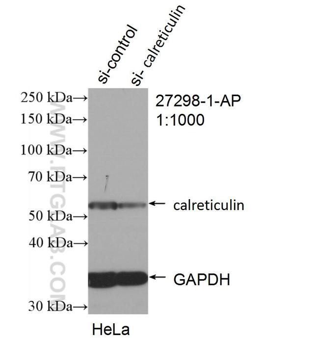 Calreticulin Antibody in Western Blot (WB)