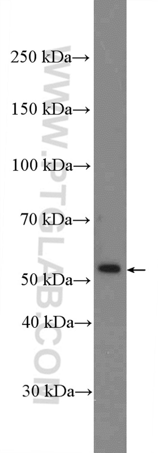 Calreticulin Antibody in Western Blot (WB)