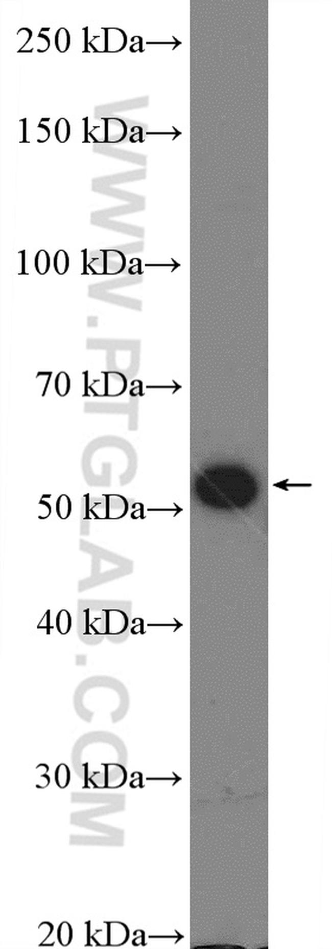 Calreticulin Antibody in Western Blot (WB)